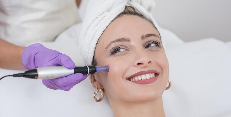 Microneedling lica -60% Maksimir