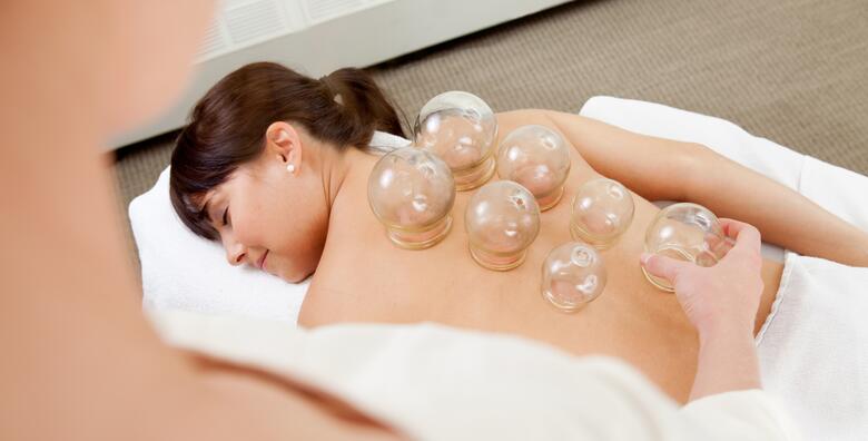 Cupping-vakum terapija -25% Prečko