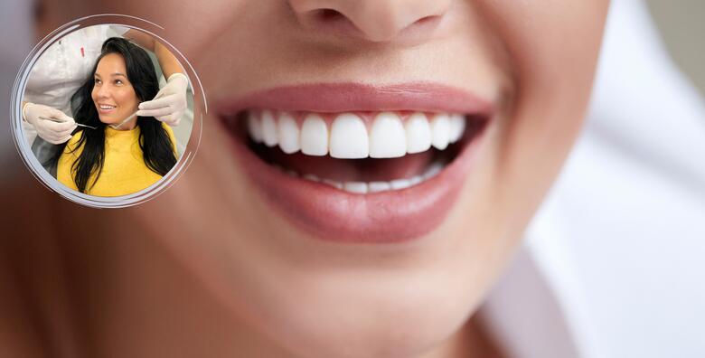 POPUST: 62% - Siguran tretman izbjeljivanja zubi obje čeljusti LED lampom (Zoom tehnologijom) u Privatnoj ordinaciji dr. Antonijela Vacula uz čišćenje zubnog kamenca te poliranje (Privatna ordinacija Dr. Antonijela Vacula)