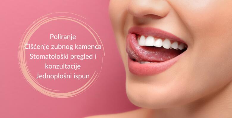 Čišćenje zubnog kamenca, poliranje, stomatološki pregled i konzultacije te jednoplošni ispun u Ordinaciji dentalne medicine Mija Šintić