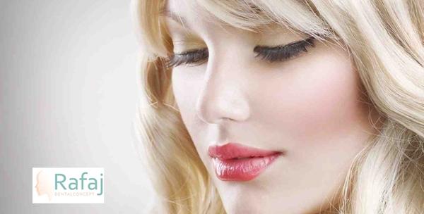 Hijaluron – popunjavanje usana ili bora na licu hijaluronom Revasensse ultra za 1.200kn!