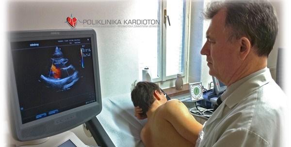 Aritmije – kardiološki pregled, ultrazvuk srca i EKG u Poliklinici Kardioton za 399kn umjesto 800kn!