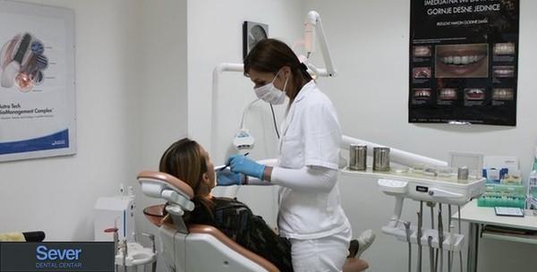 Ljuskica kompozitna – freehand bonding metodom i pregled za 499kn umjesto 1.200kn!