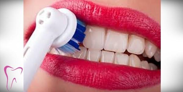 Čišćenje zubnog kamenca, pjeskarenje, impregnacija, fluoridacija i pregled za 149kn!