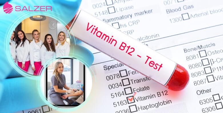LABORATORIJSKE RETRAGE VITAMINA I MINERALA IZ KRVI – otkrijte nedostatak snažnih saveznika zdravlja u Poliklinici Salzer u Zagrebu i Velikoj Gorici