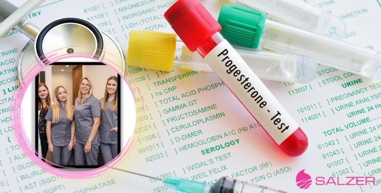 Analiza spolnih hormona za žene, Zagreb i Velika Gorica – analiza hormona ESTRADIOL (E2), FSH, LH i PROGESTERON u Poliklinici Salzer