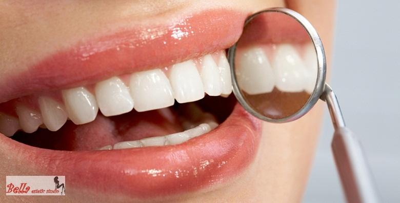 Izbjeljivanje zubi -81% Kvatrić