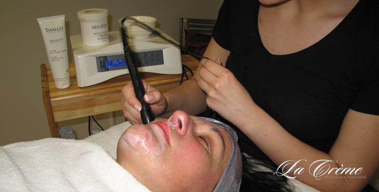 UZV čišćenje lica -63% Trešnjevka