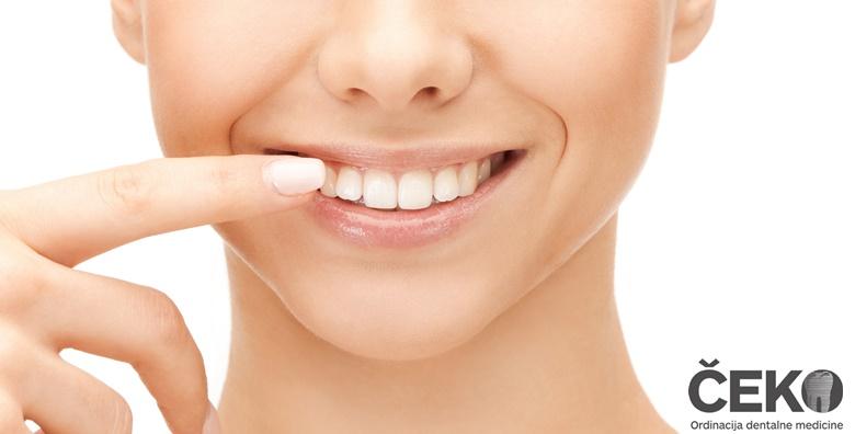 Ugradnja zubnog implantata uz gratis CBCT pretragu za 3.999 kn!