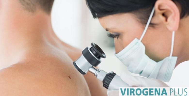 Dermatoskopski pregled madeža uz specijalistički pregled
