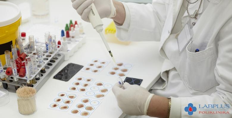 POPUST: 33% - SPLIT- Paket pretraga na spolno prenosive bolesti u Poliklinici Labplus- Testiranje iz urina na: klamidiju, trihomonas, mikoplazme i ureplazme te uzročnika gonoreje za 799 kn (Poliklinika LabPlus)