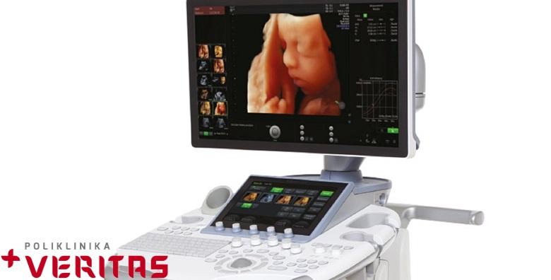 4D Live ultrazvuk bebe -33% Maksimir