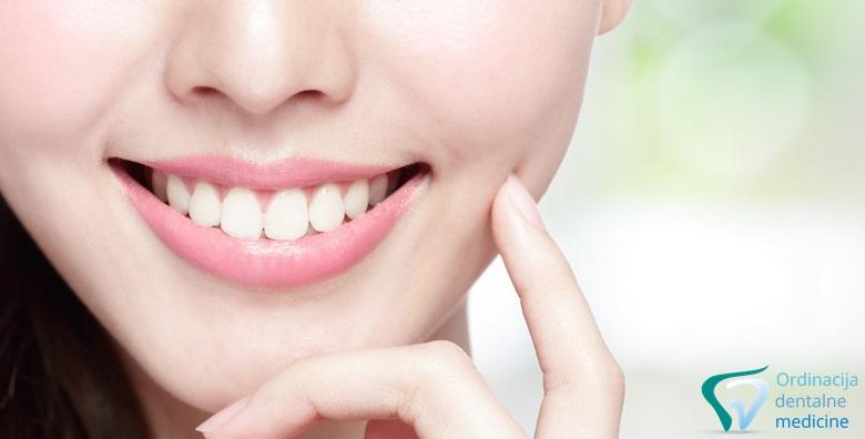 Čišćenje zubnog kamenca -80% Trnje