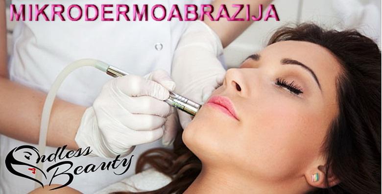 Mikrodermoabrazija -53% Centar