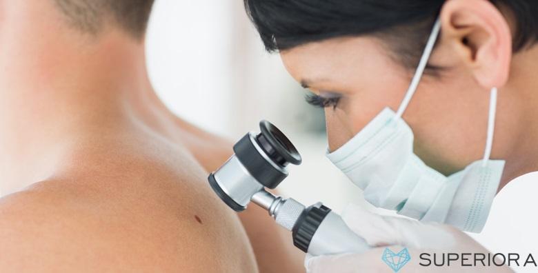 Uklanjanje madeža ili bradavica uz dermatoskopski pregled od 375 kn!