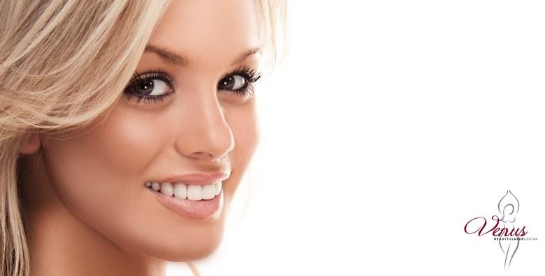 Izbjeljivanje zubi Opalescence Boost gelom i Smilite lampom