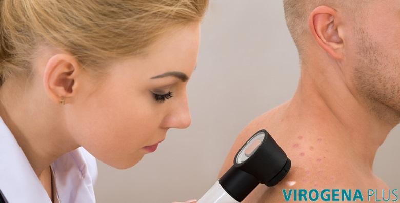 Dermatoskopski pregled madeža uz specijalistički pregled za 249 kn!