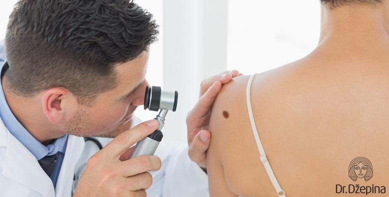 MADEŽI – uklanjanje 1 madeža uz uključenu lokalnu anesteziju u Poliklinici dr. Džepina