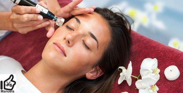 POPUST: 49% - Uklonite bore te smanjite pore i akne uz dermapen tretman lica, kemijski piling i ampulu gratis u Studiju ljepote Manuela (Studio ljepote Manuela)