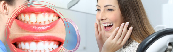 Izbjeljivanje zubi LED lampom (Zoom tehnologija), čišćenje kamenca, poliranje i pjeskarenje zubi uz pregled u Ordinaciji dentalne medicine Martina Stublić