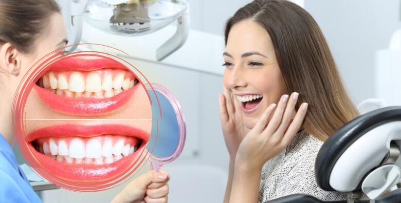 POPUST: 59% - Izbjeljivanje zubi LED lampom (Zoom tehnologija), čišćenje kamenca, poliranje i pjeskarenje zubi uz pregled u Ordinaciji dentalne medicine Martina Stublić (Ordinacija dentalne medicine Martina Stublić)