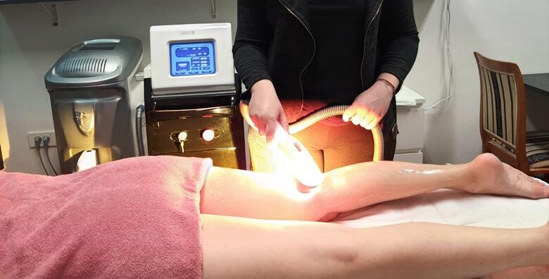 Dugotrajno uklanjanje dlačica cijelog tijela SHR metodom - 45 tretmana za 699 kn!