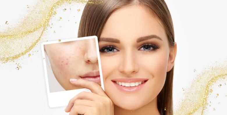 Izaberite vrhunske tretmane za regeneraciju i obnovu kože lica u Studiju ljepote Manuela