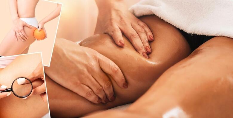 Riješite se viška vode, toksina i celulita pomoću 5 tretmana anticelulitne ručne masaže u trajanju od 30 minuta u Kozmetičkom salonu Noa