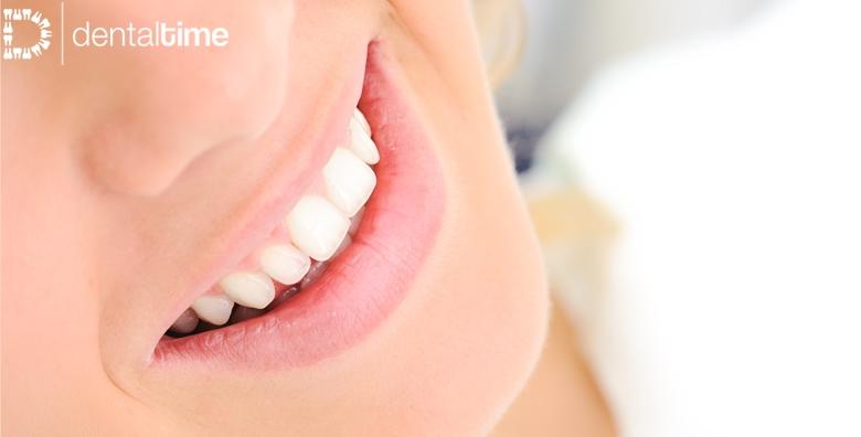 MEGA POPUST: 70% - Čišćenje kamenca, pjeskarenje zubi obje čeljusti i poliranje uz pregled i savjetovanje! Blistavi i zdravi zubi uz stručan tim u Stomatološkoj ordinaciji Dental Time (Stomatološka ordinacija Dental Time)