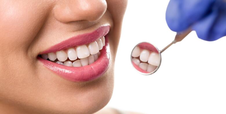 MEGA POPUST: 73% - Čišćenje kamenca, poliranje, zaštitni premaz uz pregled i savjetovanje - blistavi i zdravi zubi uz stručan tim u Stomatološkoj ordinaciji Dental Time (Stomatološka ordinacija Dental Time)