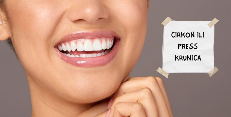 Cirkon ili press krunica – za novi osmijeh i zdravlje zubi pobrinut će se stručnjaci ordinacije Dental Time!