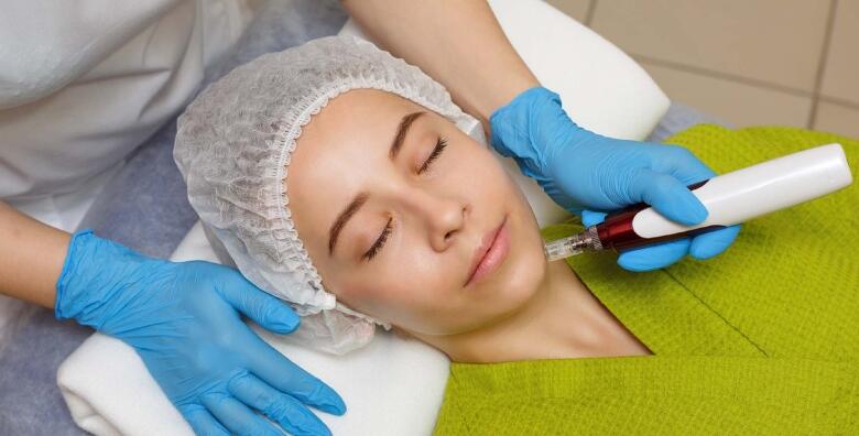 Uklanjanje bora i ožiljaka tretmanom microneedlinga Glow pen-om u Alpha et Omega – Beauty & Health centru