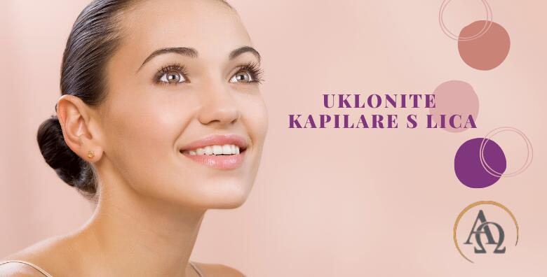 Uklanjanje kapilara s lica elektrokoagulacijom u Alpha et Omega – Beauty & Health centru