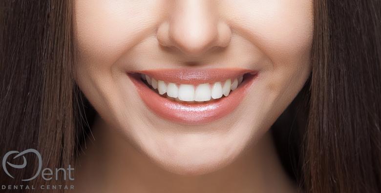 POPUST: 58% - U samo jednom dolasku popunite razmak između zubi, ispravite oblik i boju te popravite otkrhnuti i istrošeni dio uz KOMPOZITNU LJUSKICU za 499 kn! (Dental Center eDent)
