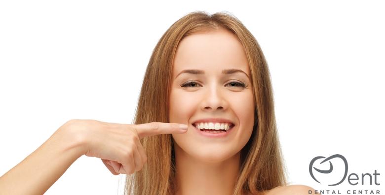 Smile Line estetska korekcija zubnog mesa - poklonite si estetski privlačan osmijeh za 1.499 kn