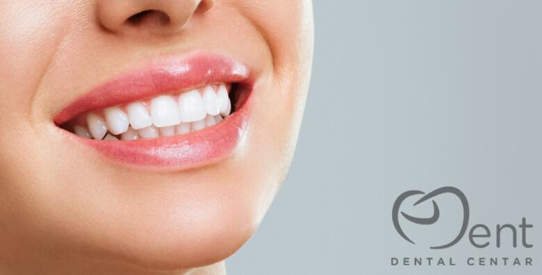POPUST: 58% - Riješite problem razmaka između zubi, ispravite oblik i boju u samo jednom dolasku  te popravite otkrhnuti i istrošeni dio uz KOMPOZITNU LJUSKICU za 499 kn! (Dental Center eDent)