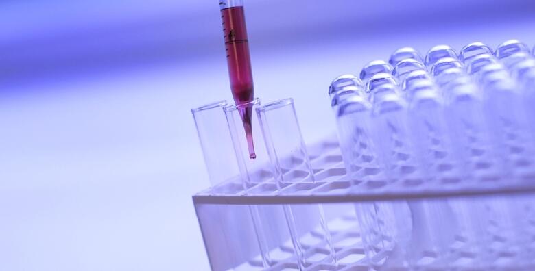Dijagnostika gljivičnih infekcija – dermatomikoze spadaju među najčešće bolesti koje narušavaju kvalitetu života! Provedite tesiranje u Poliklinici Lab Plus za 250 kn!