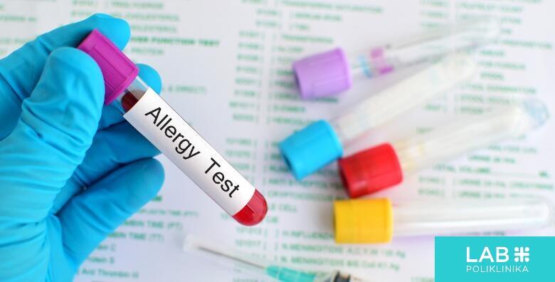 ALERGO TEST - provjerite jeste li razvili alergiju i odaberite miješani,  inhalatorni ili nutritivni panel u Poliklinici Lab Plus