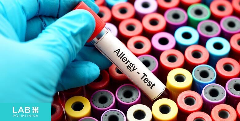 Alergo test, Poliklinika Lab Plus