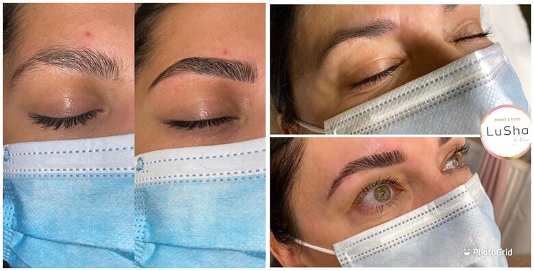 Brow Lift -21% Centar