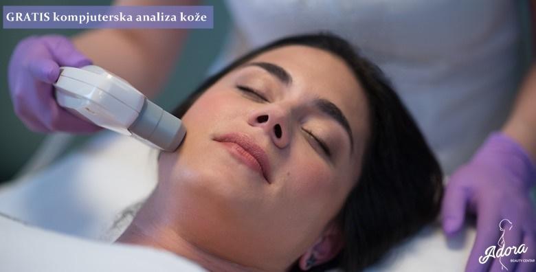 RENEW LIFT – do 10 godina mlađi izgled lica nekirurškom metodom uz revolucionarni aparat koji je pomaknuo granice estetske medicine uz rezultate koji traju do čak 2 godine
