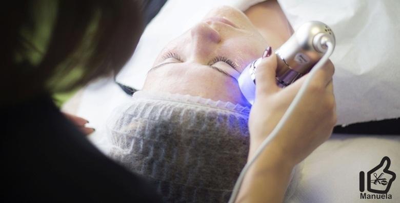 2 mikrodermoabrazije uz 3D super lift i gratis serum, masku i piling za 189 kn!
