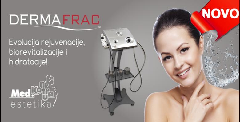DermaFrac - personalizirani tretman pomlađivanja uz konzultacije za 1.299 kn!