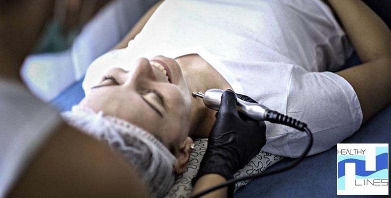 MEGA POPUST: 72% - Vrhunski 5u1 tretman pomlađivanja lica - mikrodermoabrazija, radiofrekvencija, ultrazvuk lica i vakuum masaža s radiofrekvencijom za 199 kn! (Salon Healthy Lines)
