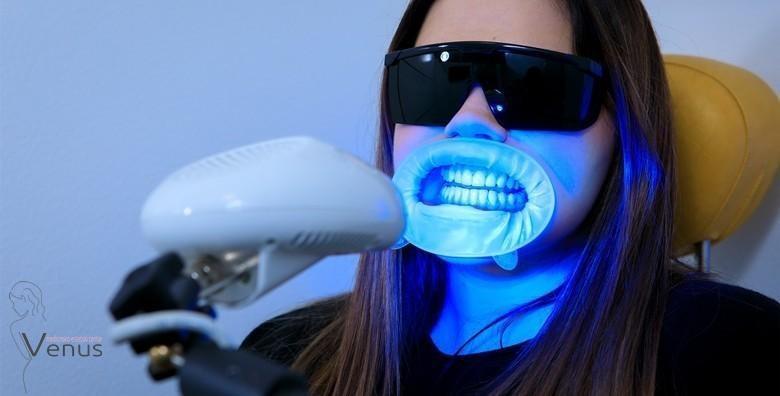 [IZBJELJIVANJE ZUBI] Inovativna Smilite LED tehnologija i Opalescence Boost gel,ODMAH vidljivi rezultati bez oštećivanja cakline za 299 kn!