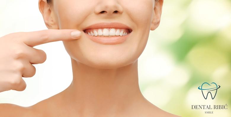 Kompozitna ljuskica ili cirkon krunica – zablistajte uz novi osmijeh i nadomjestite oštećeni ili izgubljeni dio zuba u Ordinaciji Ribić s 27 godina iskustva