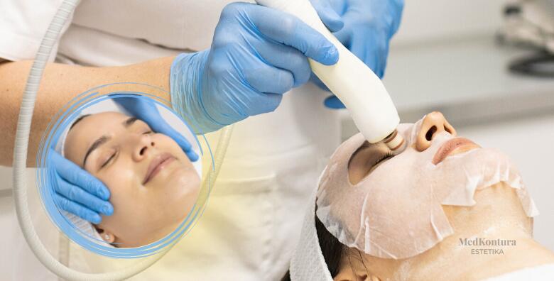 Face Up regeneracijski tretman pomlađivanja lica, vrata i dekoltea u Med.Kontura Estetici