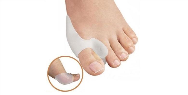 2 štitnika za deformirane palčeve - hallux valgus (čukalj) za samo 25 kn!