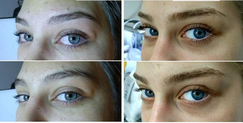 Lash lift uz bojanje trepavica i korekciju obrva u salonu Glitter & glam za samo 99 kn!