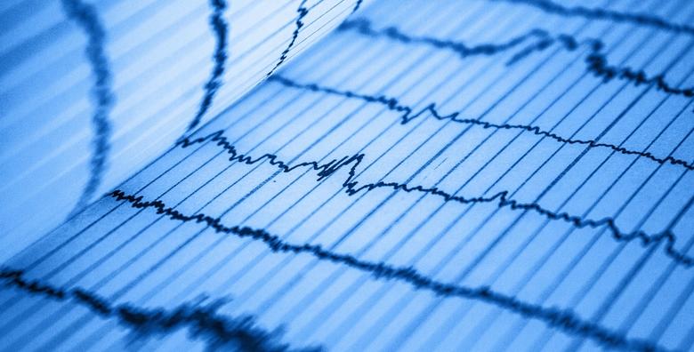 Ergometrija, UZV i EKG -21%